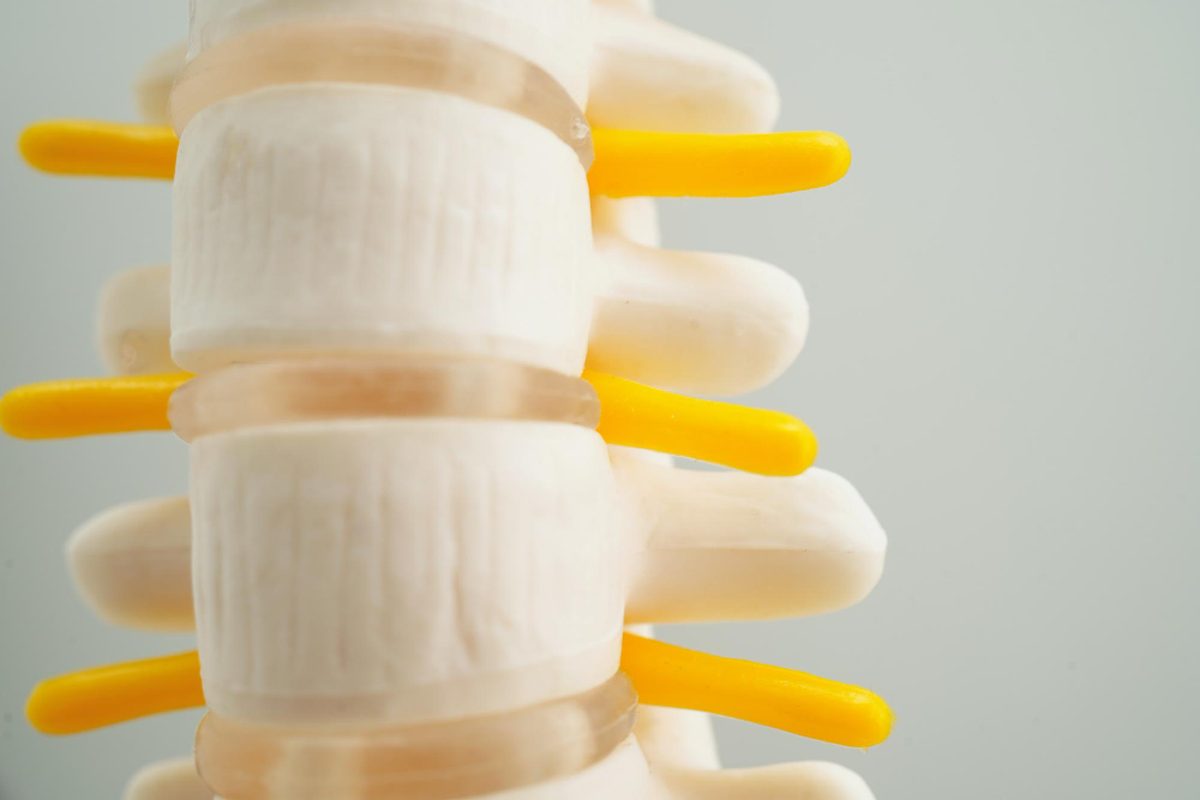Herniated Disc